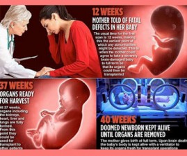 abortion
