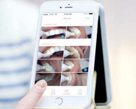 APP