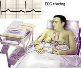 TCR-ECG