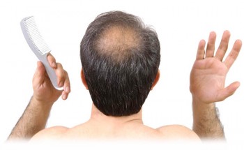 hairfall