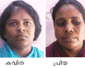 TVM-ARREST